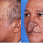 You Won’t Believe How Conrado’s Nose Transformed Overnight! See the Shocking Before and After!