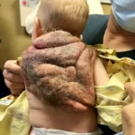 Meet the Real-Life Superhero Baby Born with a Shell: The Incredible Story of a Ninja Turtle Come to Life!