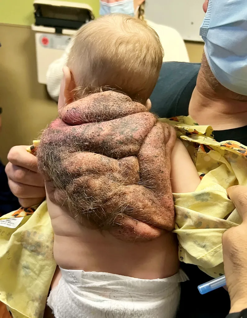 Meet the Real-Life Superhero Baby Born with a Shell: The Incredible Story of a Ninja Turtle Come to Life!