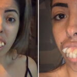 Millions Stunned by Woman’s Teeth Transformation, But Did You Notice What’s Off?