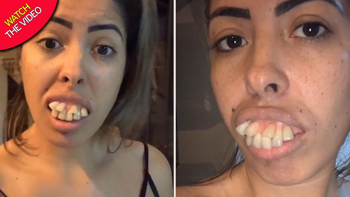 Millions Stunned by Woman’s Teeth Transformation, But Did You Notice What’s Off?