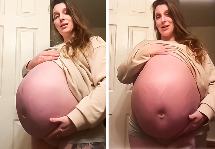 Eight Babies on Board? Mom’s Giant Bump Sparks Wild Guesses!