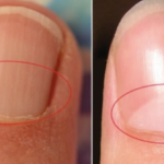 If You Don’t Have A Half Moon Shape On Your Nails, Visit A DOCTOR Immediately