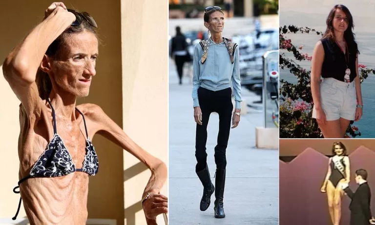 THE WORLD’S THINNEST WOMAN’S WILL LEAVE YOU SPEECHLESS!