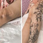 People Who Transformed Their Scars Into Pieces Of Art