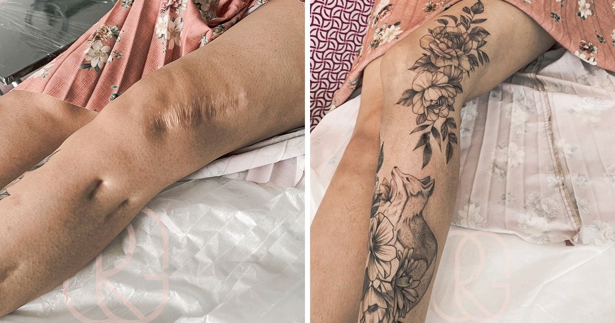 People Who Transformed Their Scars Into Pieces Of Art