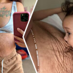 A Woman Shows The Raw Truth Of Postpartum Bodies